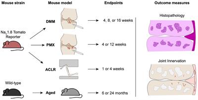 Intra-articular sprouting of nociceptors accompanies progressive osteoarthritis: comparative evidence in four murine models